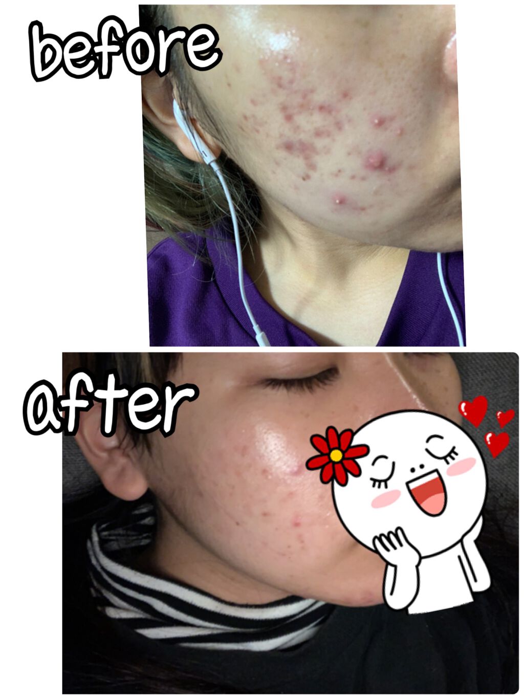 乳液・敏感肌用・高保湿タイプ/無印良品/乳液を使ったクチコミ(1枚目)