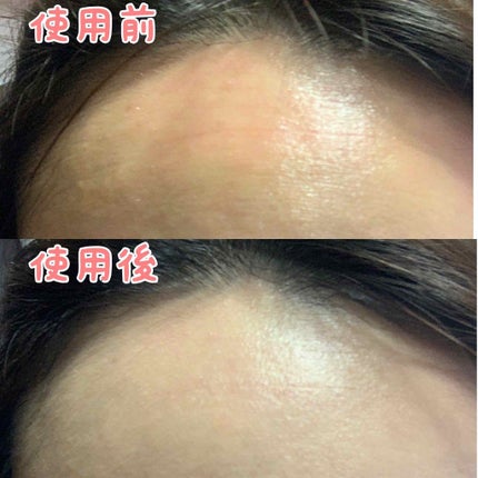 ドクタージャルト シカペア リカバー (第2世代)/Dr.Jart+/フェイスクリームを使ったクチコミ(3枚目)