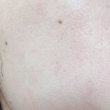 CICA デイリースージングマスク/VT/シートマスク・パックを使ったクチコミ(5枚目)