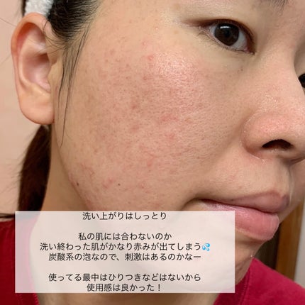 マイクロムース リフレッシャー/ALBLANC/泡洗顔を使ったクチコミ(5枚目)