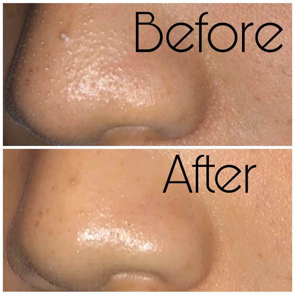 ポアスキンケアステップス/IPSA/美容液を使ったクチコミ（2枚目）