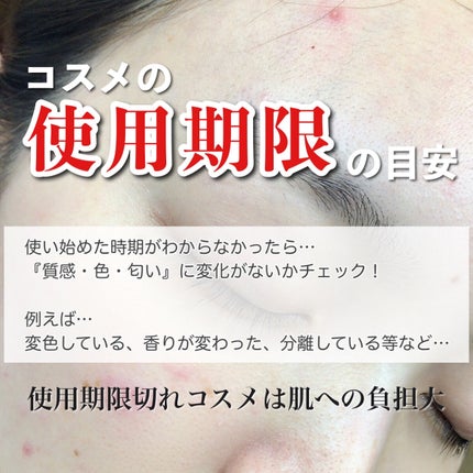 こひなたりり on LIPS 「◯◯守らなかったら肌荒れしました…美容好きほど陥りやすい罠とは..」(5枚目)