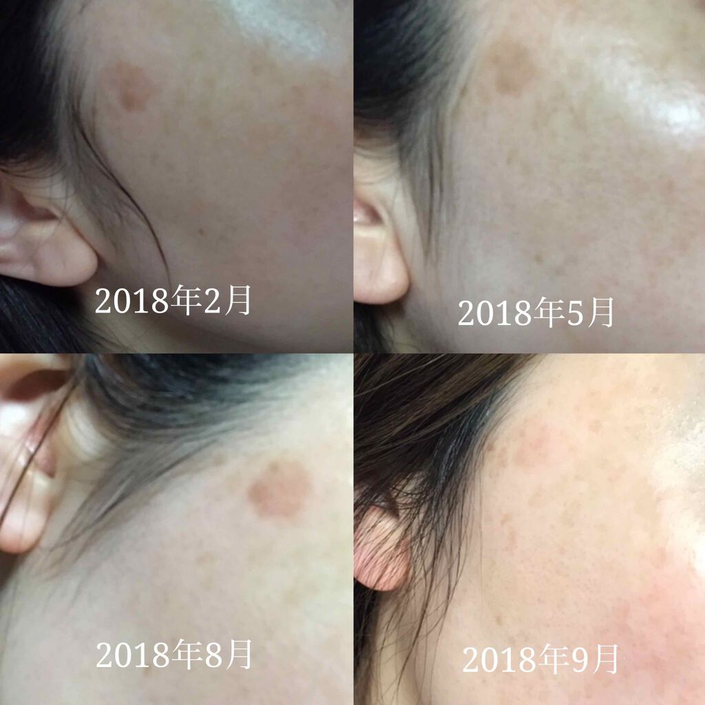 ブライトニングフォーミュラ/メコゾーム/フェイスクリームを使ったクチコミ(3枚目)