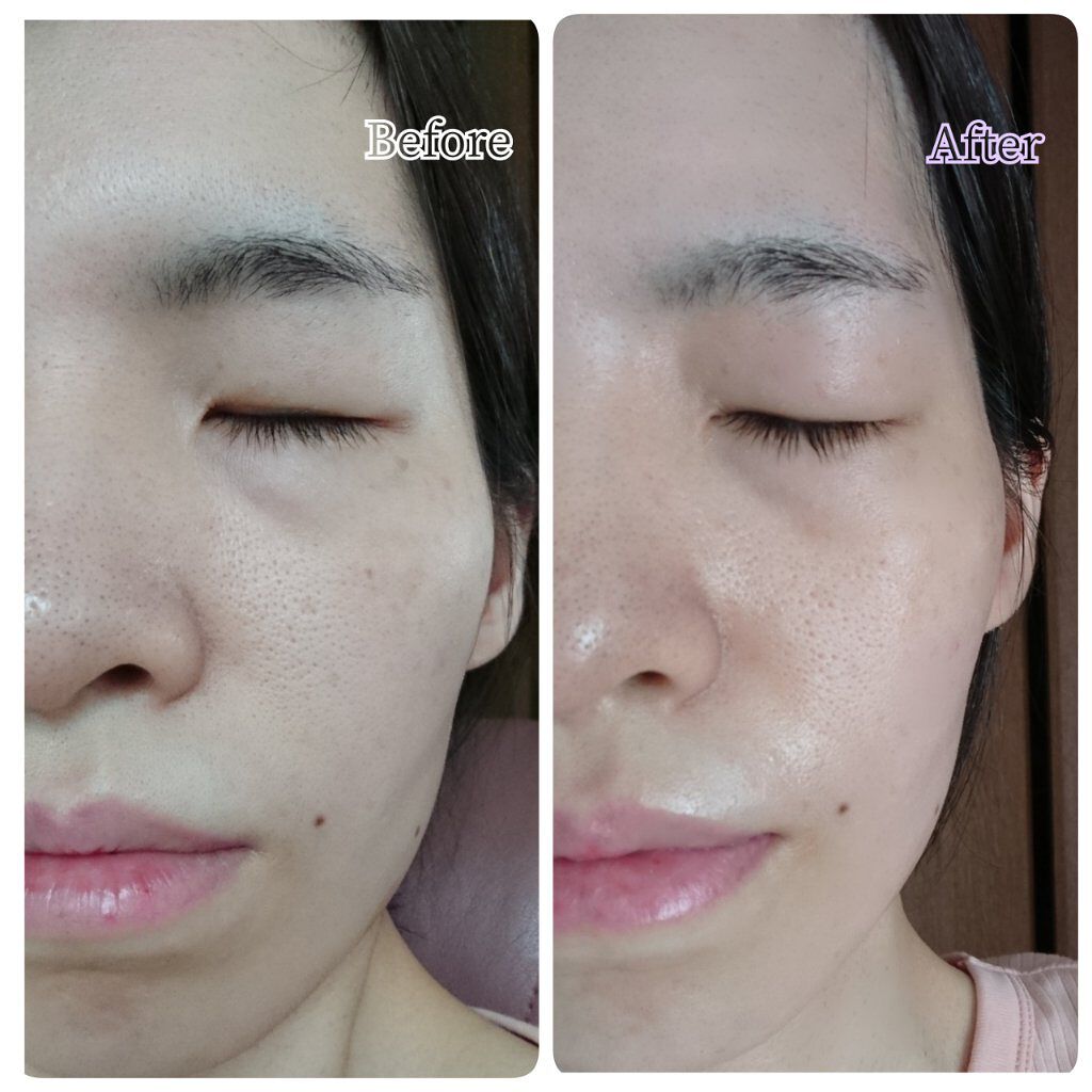 モイストバランス ローション/ACSEINE/化粧水を使ったクチコミ(5枚目)