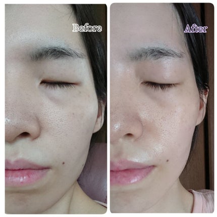 モイストバランス ローション/ACSEINE/化粧水を使ったクチコミ(5枚目)