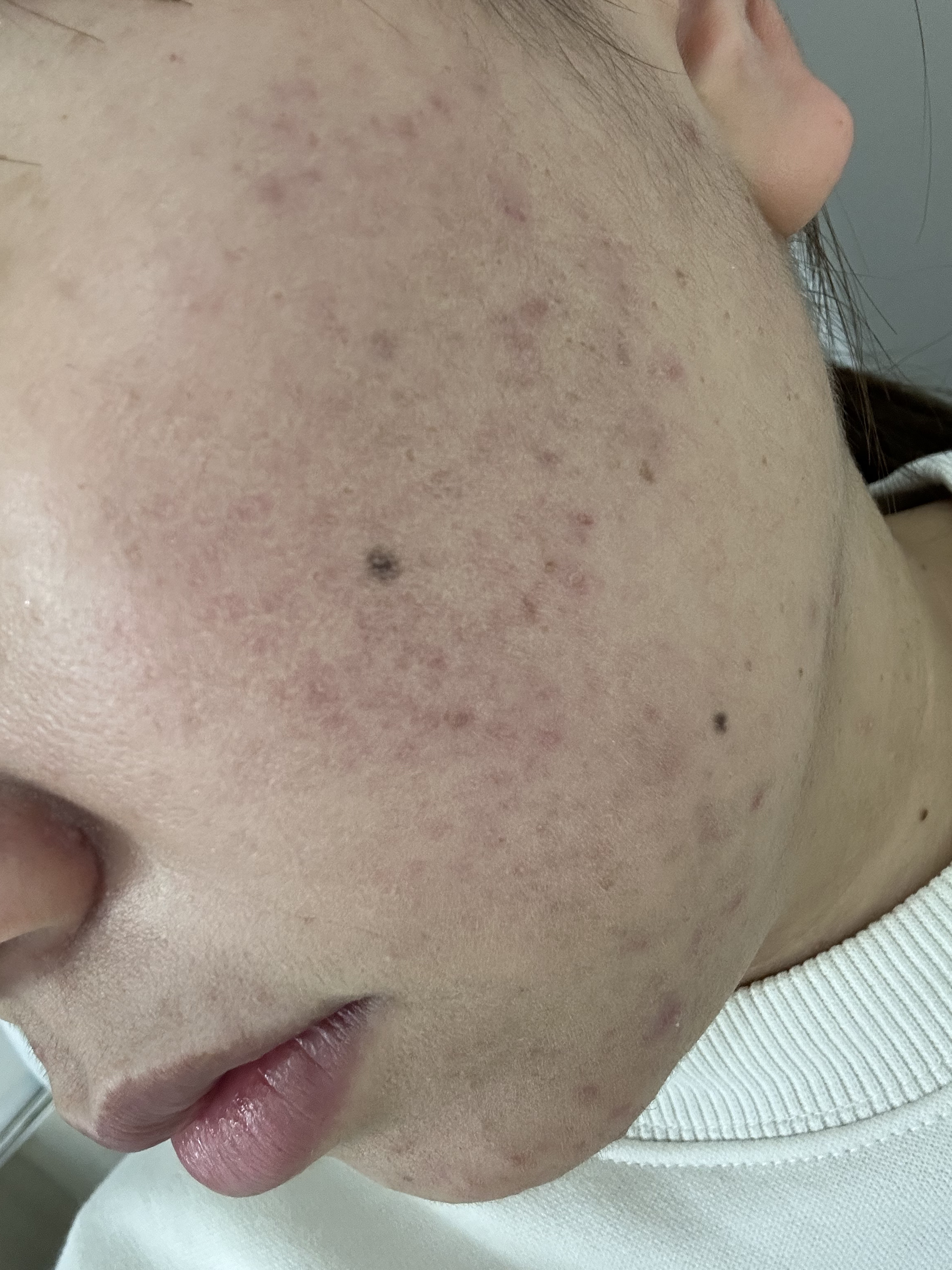 ミシャ グロウ スキンバーム（Ｒ）/MISSHA/化粧下地を使ったクチコミ（3枚目）