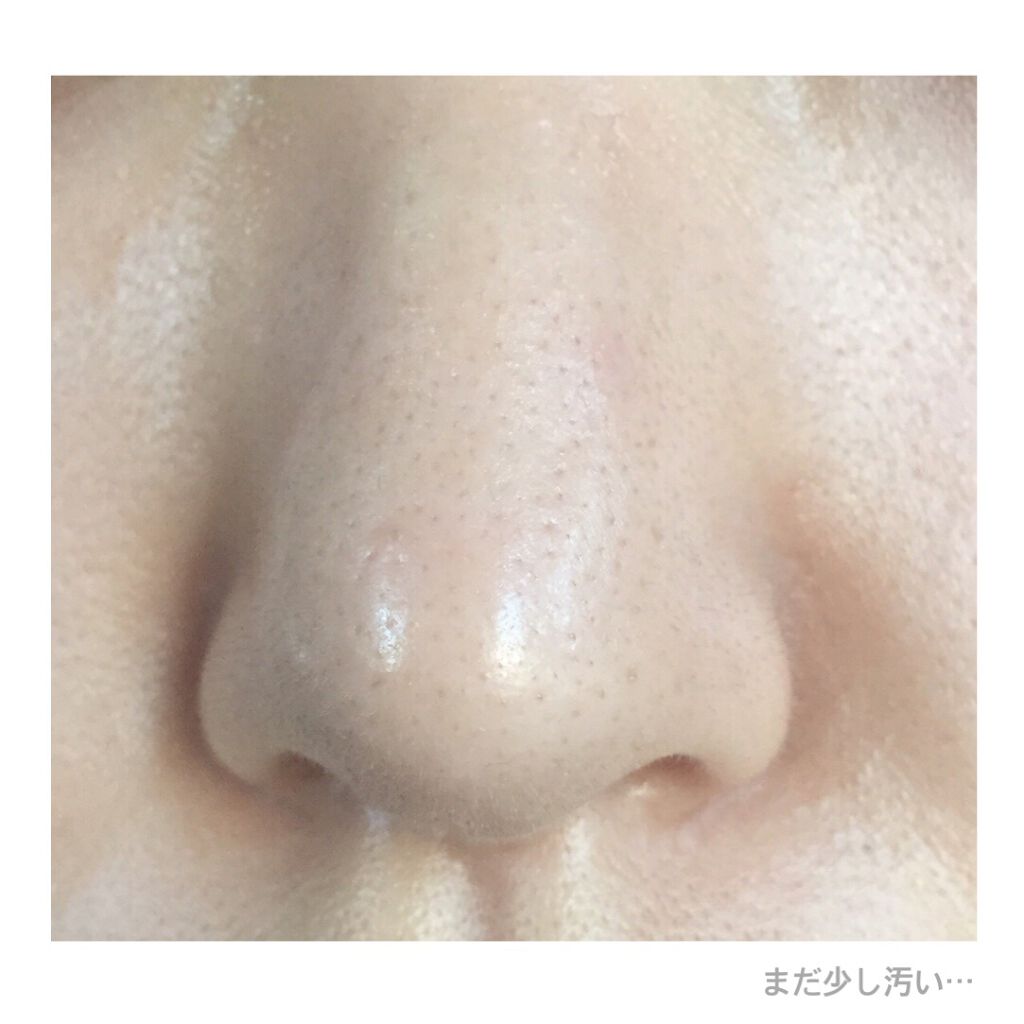 ジョンソン ベビーオイル 無香料/ジョンソンベビー/ボディオイルを使ったクチコミ(4枚目)