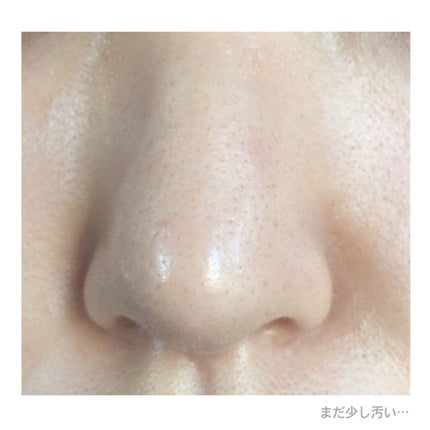 ジョンソン ベビーオイル 無香料/ジョンソンベビー/ボディオイルを使ったクチコミ(4枚目)