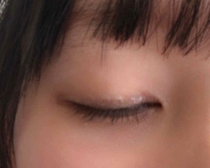 ハイブリッドフィルム/アイトーク/二重まぶた用アイテムを使ったクチコミ(2枚目)