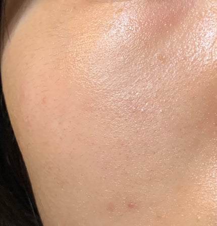 クリアウェルネス ナチュラル ドリップ/雪肌精/化粧水を使ったクチコミ(4枚目)