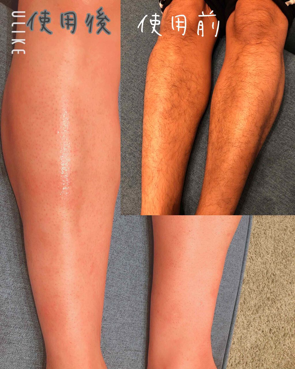 バスタイム除毛クリーム 敏感肌用 Veetの使い方を徹底解説 チクチク肌な方必見 女子にかか By M I I I 乾燥肌 Lips