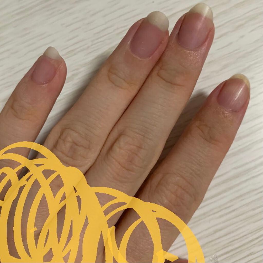 ネイルベッドオイル/アンドネイル/ネイルオイル・トリートメントを使ったクチコミ(2枚目)