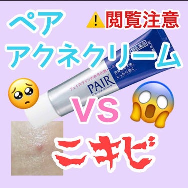 ペアアクネクリームW(医薬品)/ペア/その他スキンケアグッズを使ったクチコミ（1枚目）