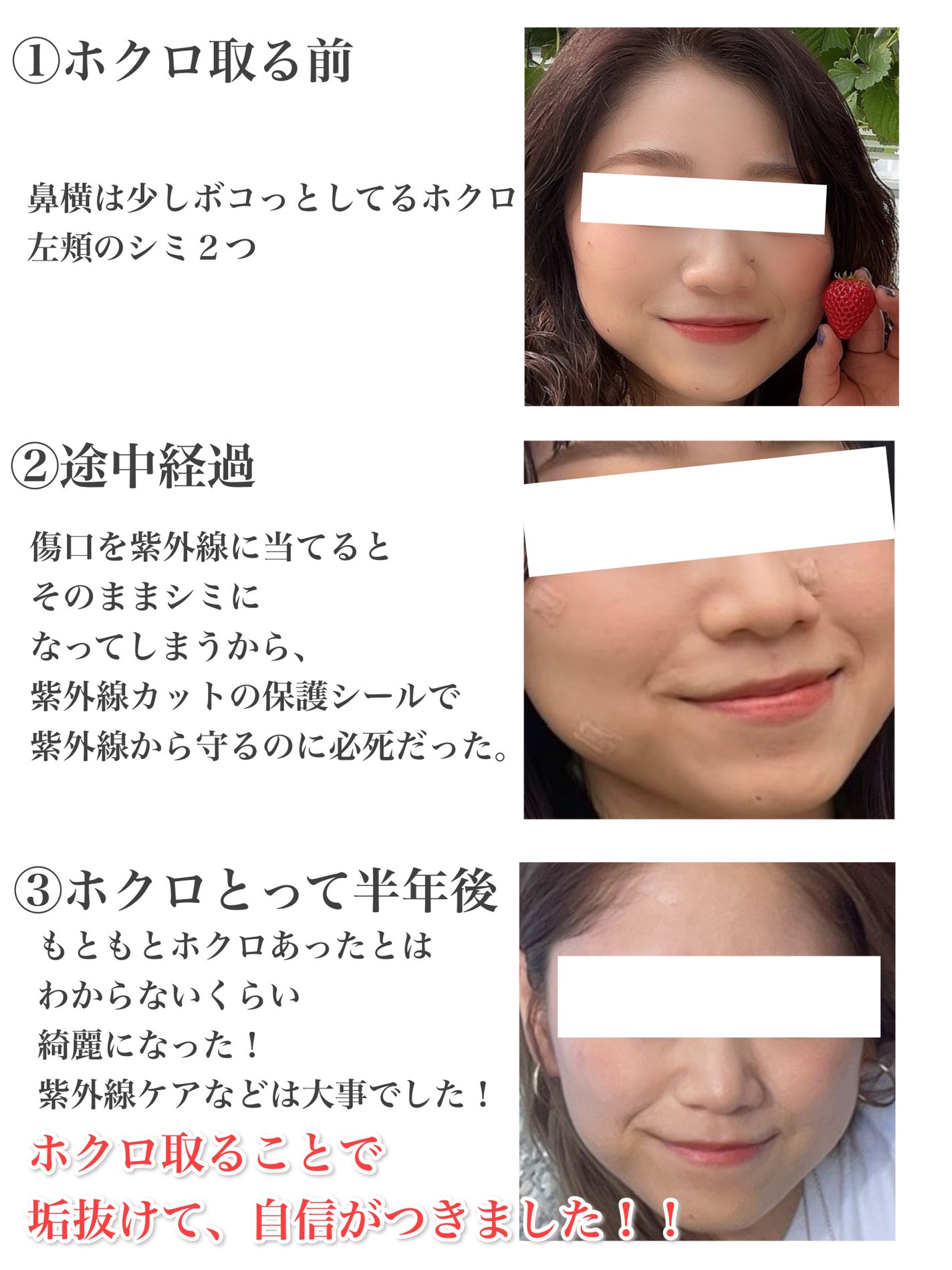 キズを早くきれいに治すパッチ/matsukiyo/その他を使ったクチコミ(2枚目)