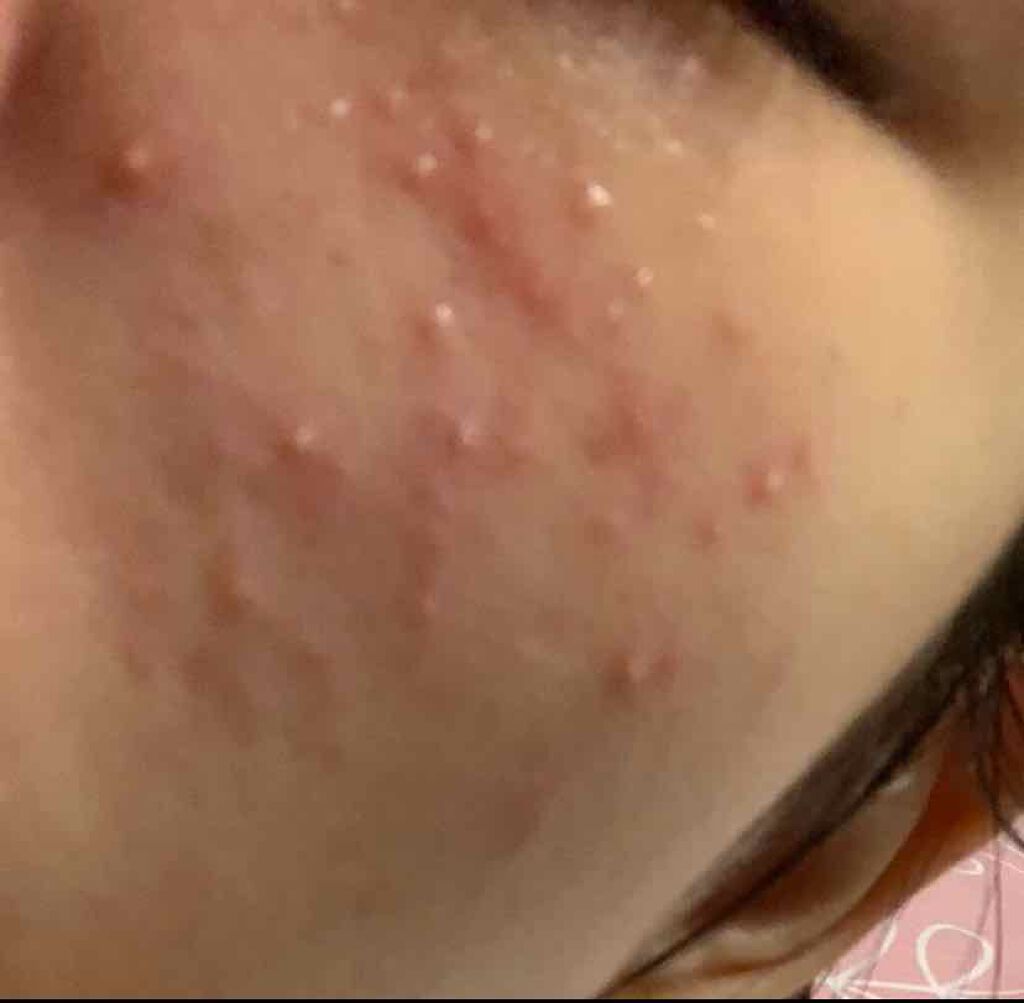 うるおいジェリー とてもしっとり/ビオレ/オールインワン化粧品を使ったクチコミ(1枚目)