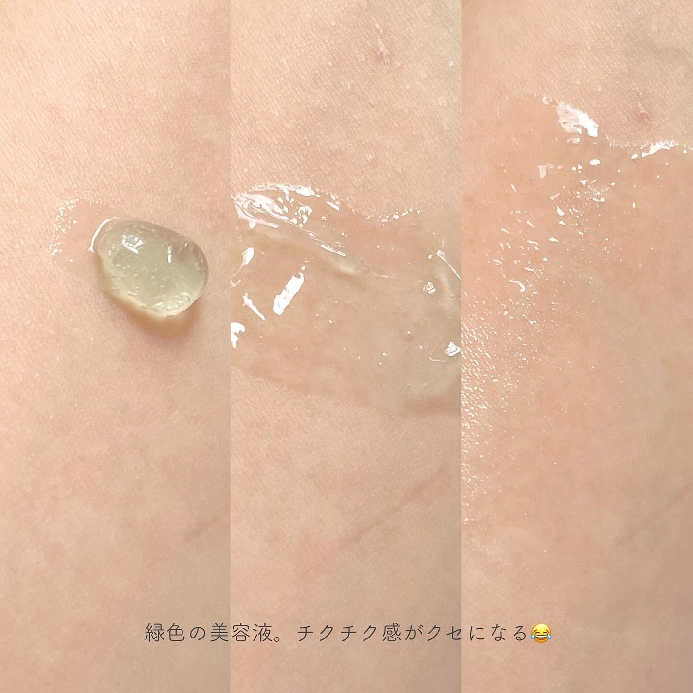 ポアセラショットエクソソームスピキュールセラム& ミニマイザー美顔/MEDITHERAPY/美容液を使ったクチコミ(3枚目)