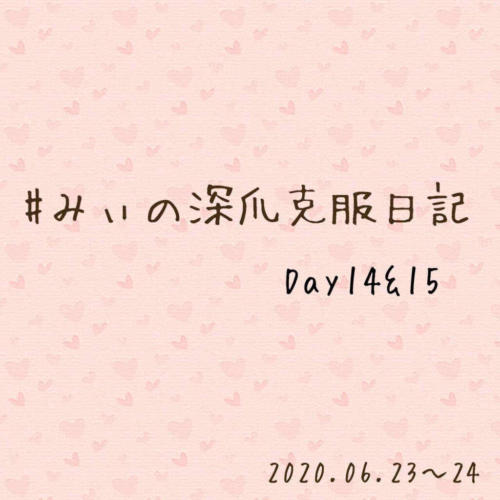 アトリックス ハンドジェル/アトリックス/ハンドジェルを使ったクチコミ(1枚目)
