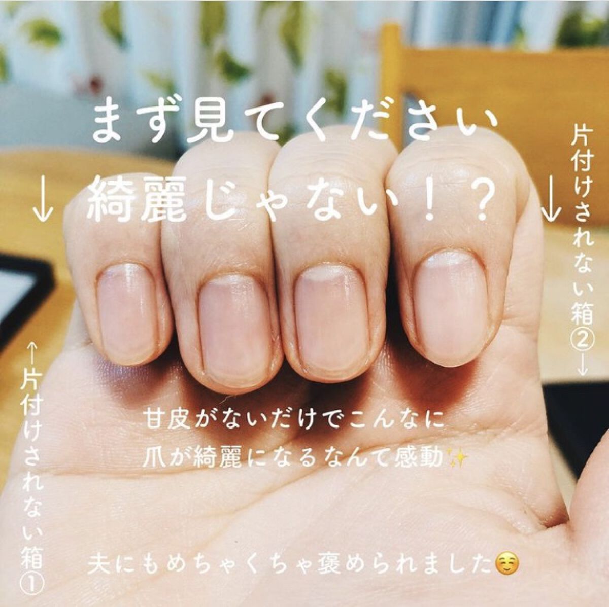 クナイプビオ オイル 20mL （旧パッケージ）/クナイプ/ボディオイルを使ったクチコミ（2枚目）