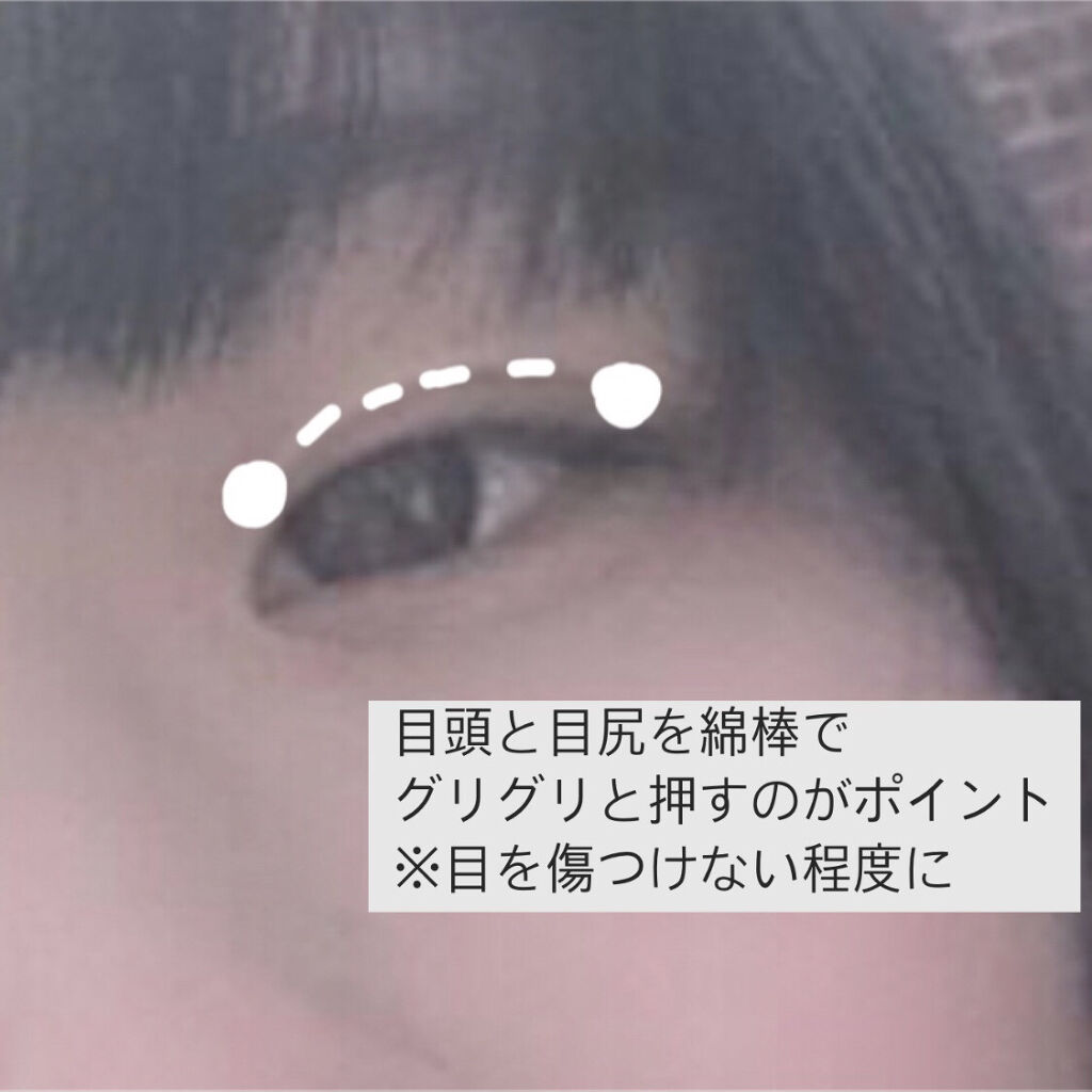 オロナインＨ軟膏 (医薬品)/オロナイン/その他を使ったクチコミ（2枚目）