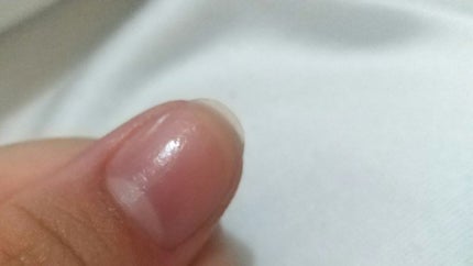 Mimits モイストネイルオイル/ビー・エヌ/ネイルオイル・トリートメントを使ったクチコミ(4枚目)