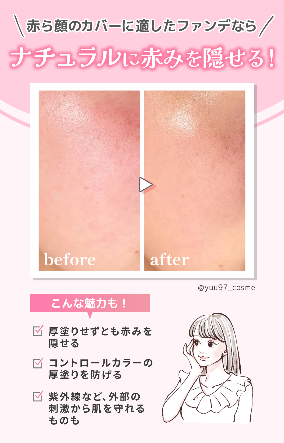 赤ら顔のカバーに適したファンデならナチュラルに赤みを隠せる！厚塗りせずとも赤みを隠せる・コントロールカラーの厚塗りを防げる・ 紫外線など、外部の刺激から肌を守れるものもあるのが魅力。