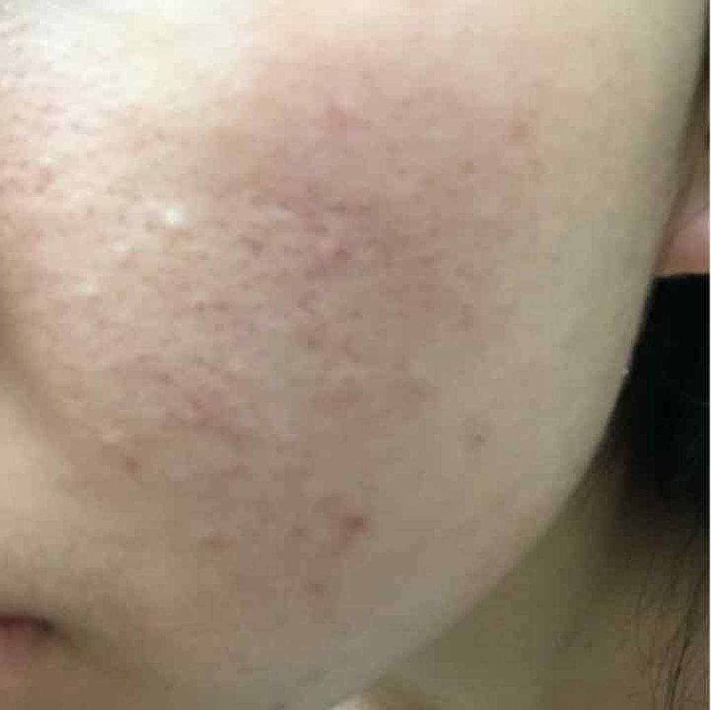 スクワビューティ 薬用素肌いきいきパック/スクワビューティー/フェイスクリームを使ったクチコミ（2枚目）