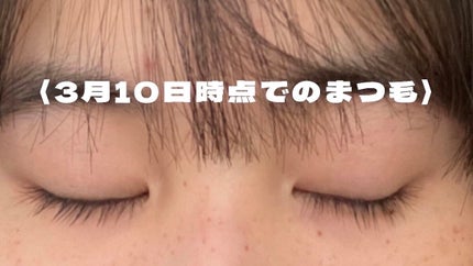 アイラッシュセラムEX/ヒロインメイク/まつげ美容液を使ったクチコミ(9枚目)
