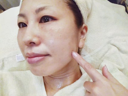 sachi on LIPS 「先日、RESALONで無針水光注入×BMSフェイシャルの施術を..」(7枚目)