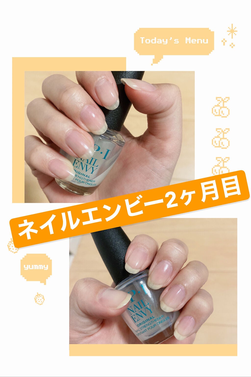 ネイルエンビー/O・P・I/ネイルオイル・トリートメントを使ったクチコミ(1枚目)