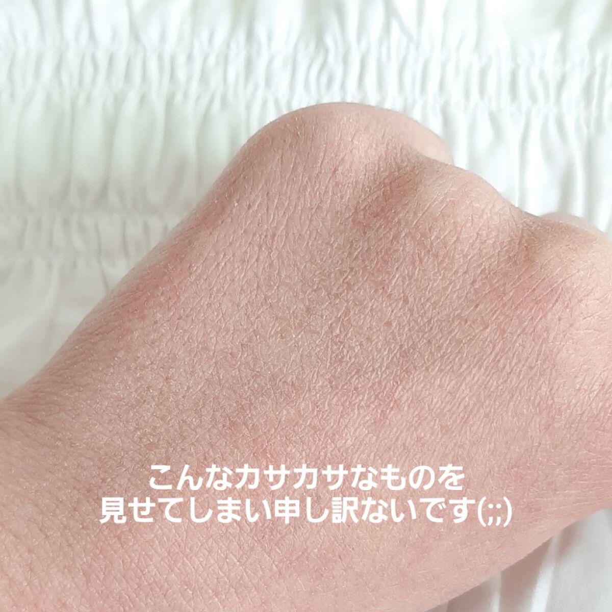 リップトリートメントバーム ピュアレッド/ISOI/リップバームを使ったクチコミ（3枚目）