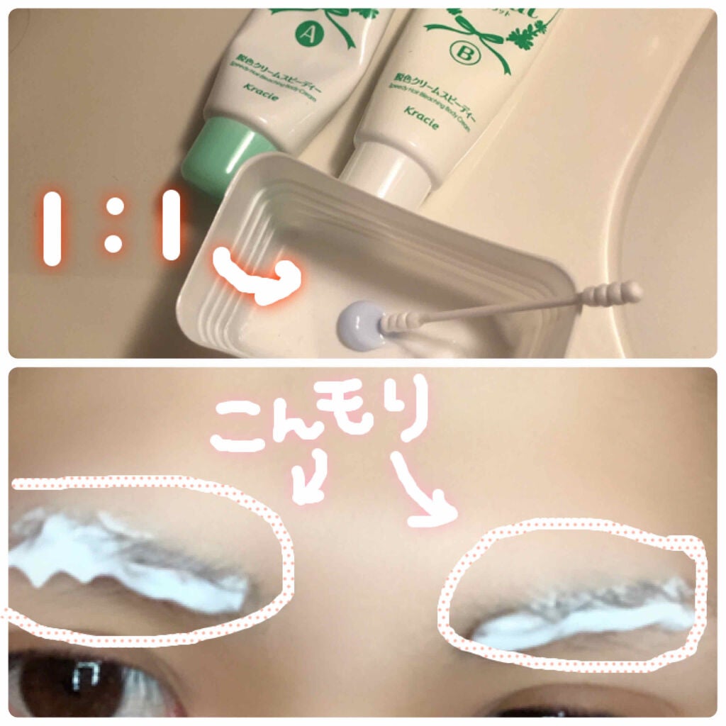 脱色クリーム スピーディー/エピラット/ムダ毛ケアを使ったクチコミ(2枚目)