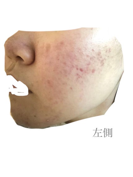 ハトムギ化粧水(ナチュリエ スキンコンディショナー R )/ナチュリエ/化粧水を使ったクチコミ(2枚目)