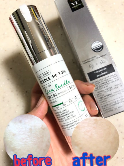 リードルショット300/VT/美容液を使ったクチコミ(7枚目)