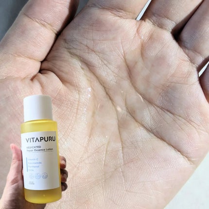 ãã¿ãã« ãªã㢠ãšãã»ã³ã¹ããŒã·ã§ã³/VITAPURU/åç²§æ°Žã䜿ã£ãã¯ãã³ãïŒ3æç®ïŒ