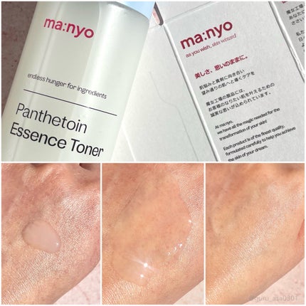 パンテトイン エッセンス トナー/manyo/化粧水を使ったクチコミ(3枚目)