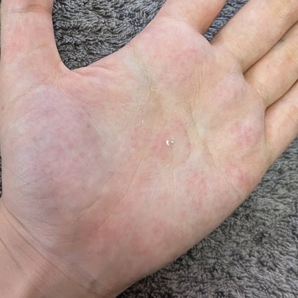 131 ポア クリアリング セラム/Celladix/美容液を使ったクチコミ(3枚目)