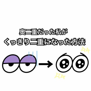 アイテープ片面(のびる)絆創膏タイプ スリム 120枚/セリア/二重まぶた用アイテムを使ったクチコミ（1枚目）