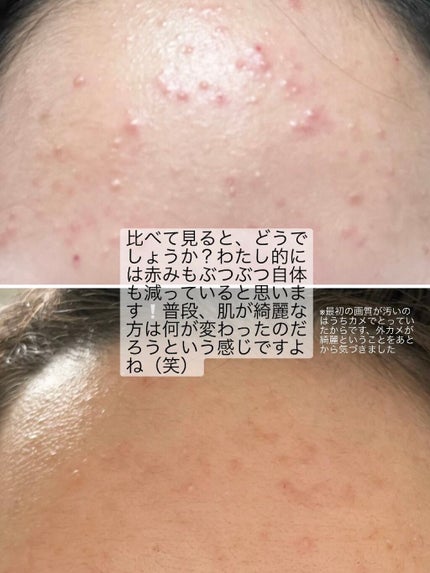 サミュ PHセンシティブクリーム/SAM'U/フェイスクリームを使ったクチコミ(4枚目)