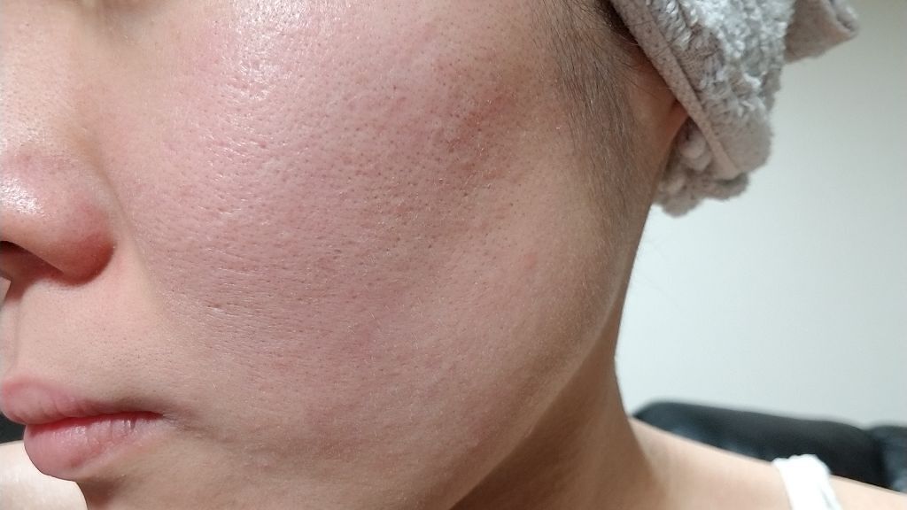 導入化粧液/無印良品/ブースター・導入液を使ったクチコミ(3枚目)