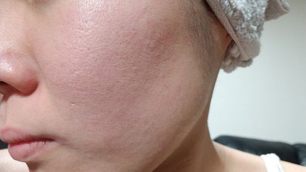 導入化粧液/無印良品/ブースター・導入液を使ったクチコミ(3枚目)