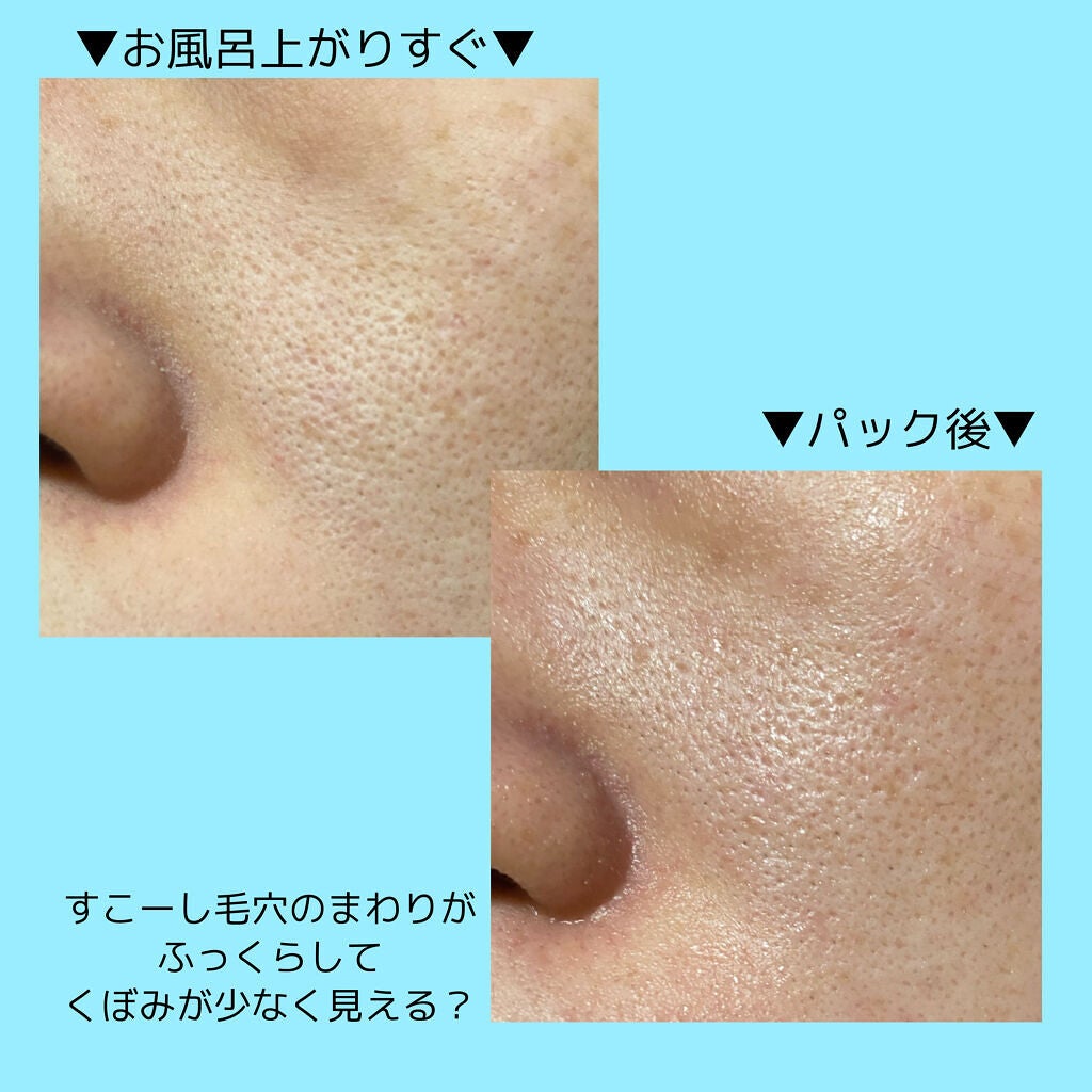 クリアトライアルセット M(しっとりタイプ)/オルビス/トライアルキットを使ったクチコミ(2枚目)