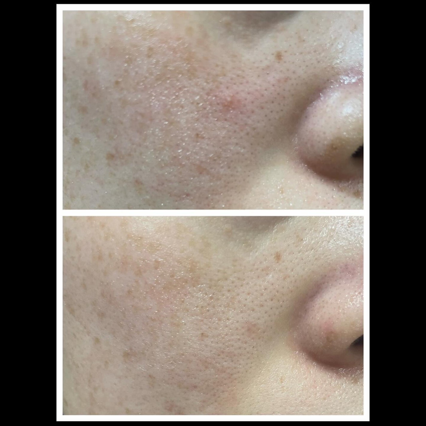 パンテショット675/COSNORI/美容液を使ったクチコミ(5枚目)