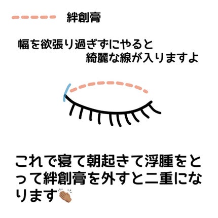 るにょ on LIPS 「こんにちは🌐🤍今回は私の二重のなり方についてです(◜ᴗ◝)蒙古..」(5枚目)