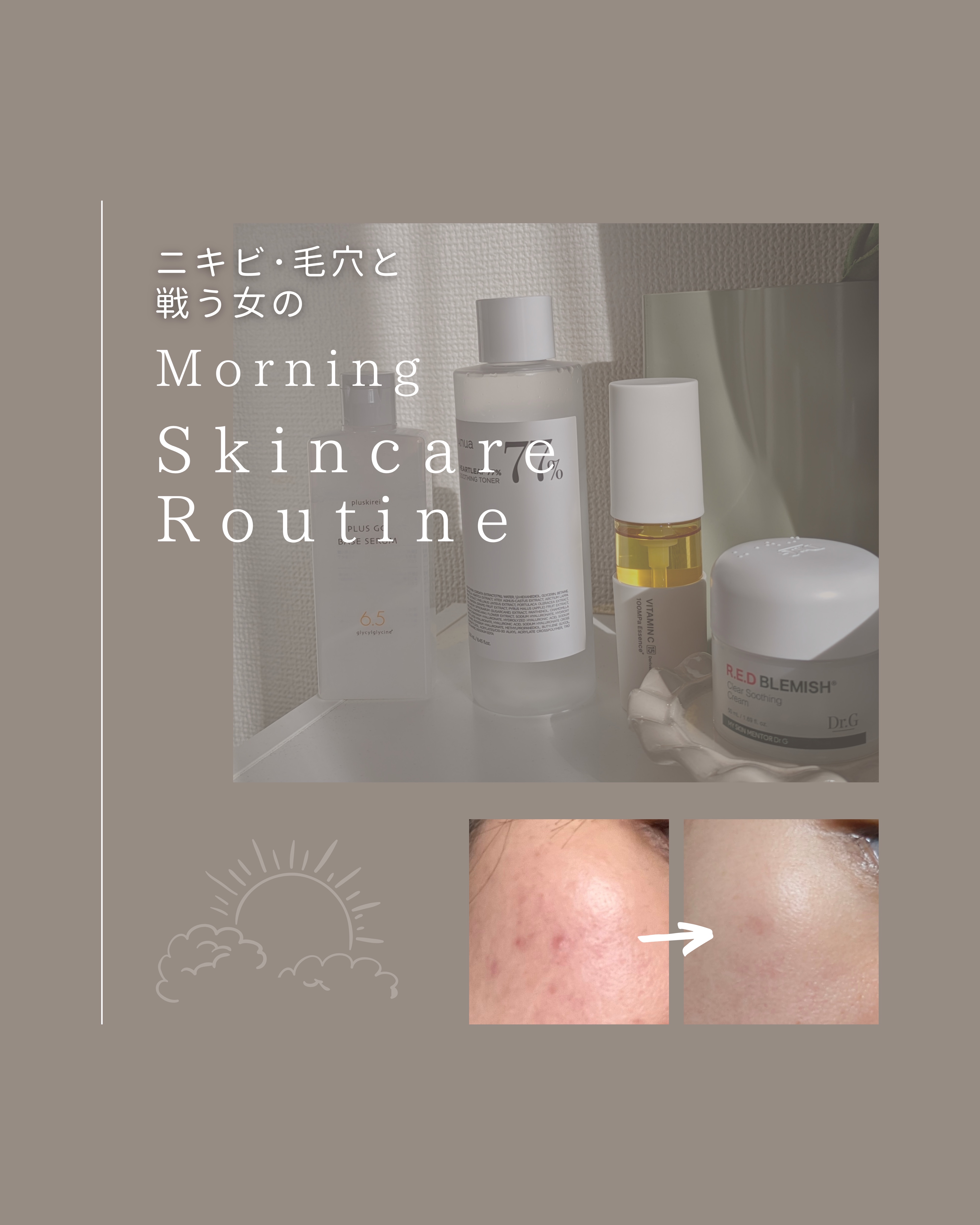 ドクダミ 77 スージングトナー/Anua/化粧水を使ったクチコミ（1枚目）