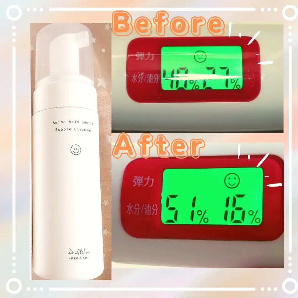 アミノ酸 ジェントル バブル クレンザー/Dr.Althea/泡洗顔を使ったクチコミ(5枚目)