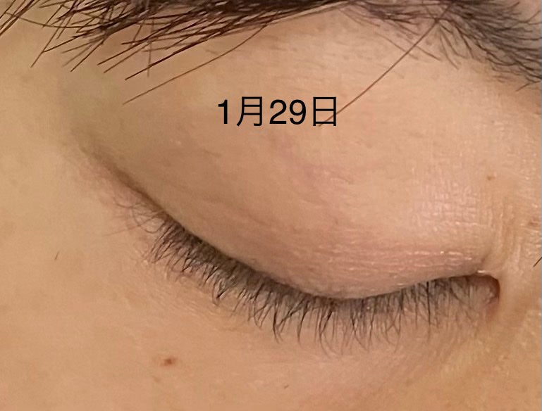 ラッシュアディクト アイラッシュコンディショニングセラム/soaddicted/まつげ美容液を使ったクチコミ(3枚目)