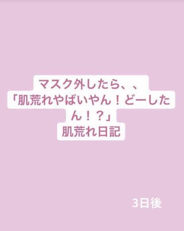 3日目の肌です！！
鼻左横のニキビ1つはほぼ治りニキビ跡っぽくなっていて、もう1つは悪化？しています😢
右頬にあったニキビの膨らみも小さくなっているような、？
これからも頑張ります💪💪 