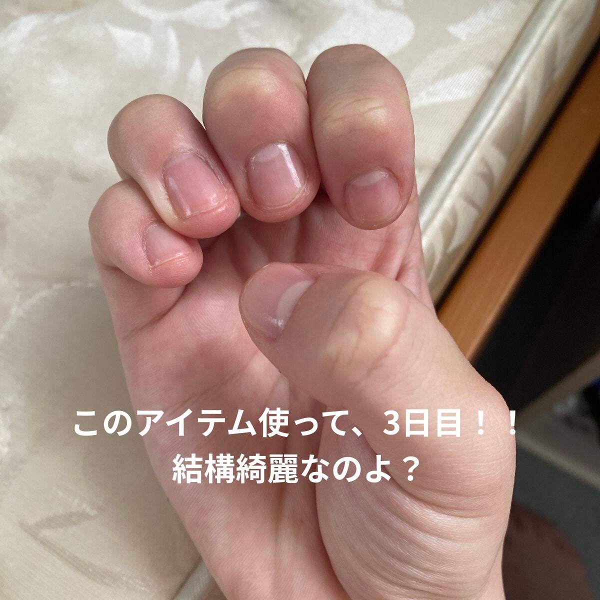 クイッククリスタルコートⅡ/ネイリスト/ネイルトップコートを使ったクチコミ(5枚目)