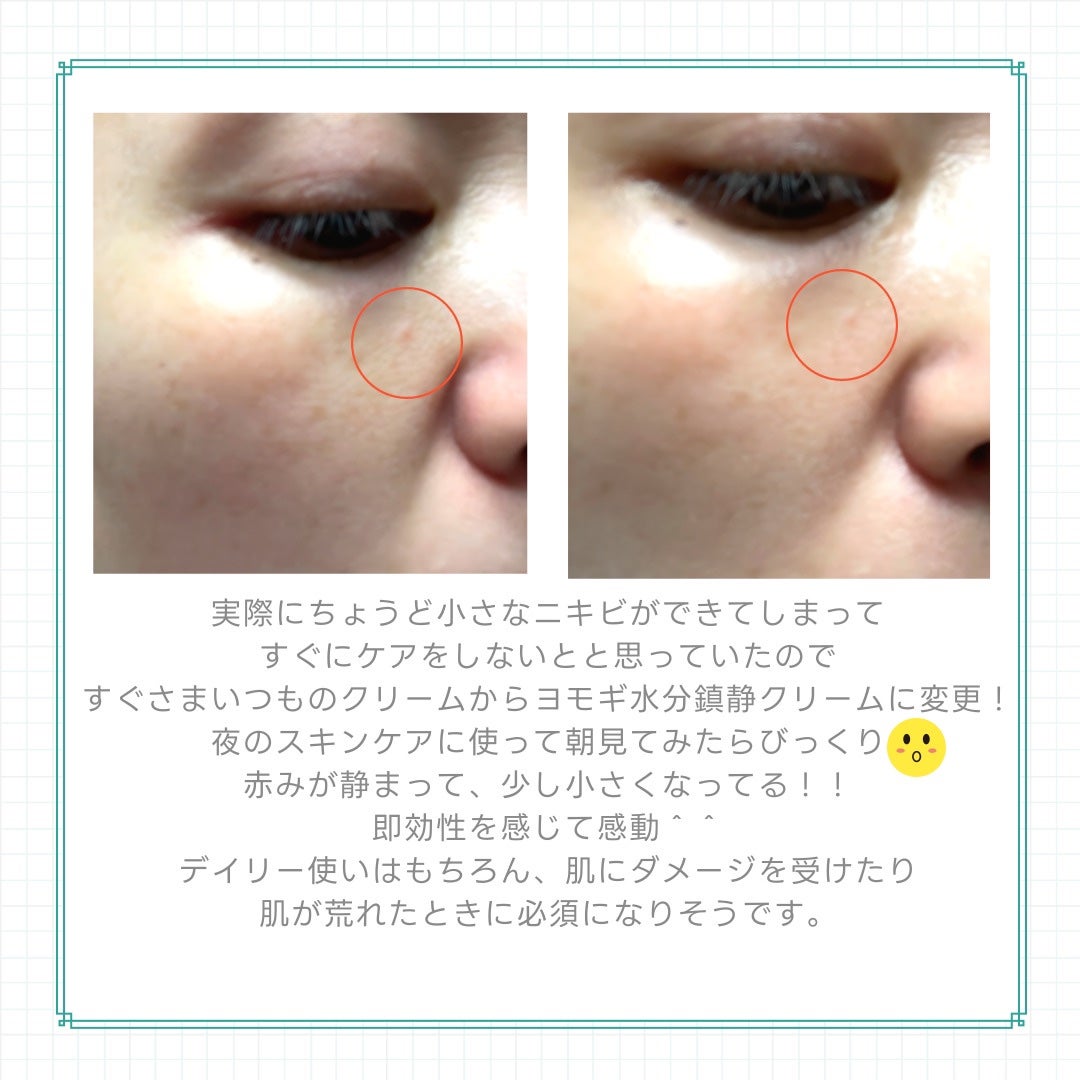 ピュアアルテミシア カーミングウォータークリーム/HANYUL(ハンユル)/フェイスクリームを使ったクチコミ(7枚目)