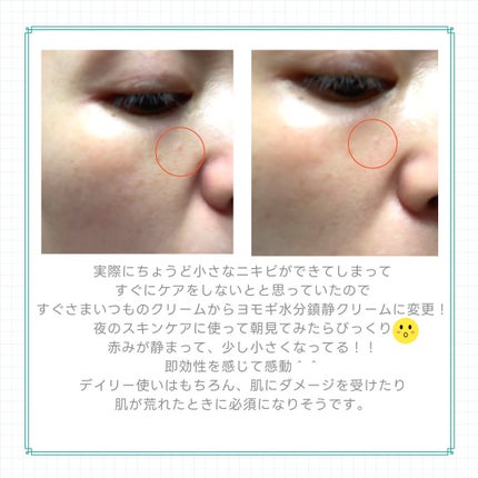 ピュアアルテミシア カーミングウォータークリーム/HANYUL(ハンユル)/フェイスクリームを使ったクチコミ(7枚目)